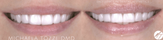 cosmetic dentist henderson Michaela Tozzi, DMD